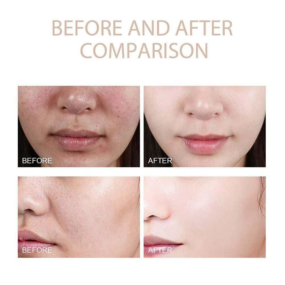 Dr. Melaxin Peel Shot White and Black Rice Exfoliating Essence Skin Lightening Contro Moisturizing Oil-Control Gentle Skin Care